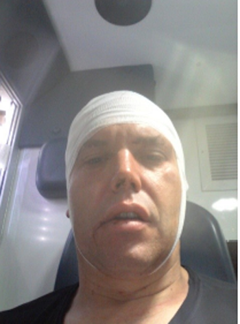 Self-portrait from the ambulance after my assault...